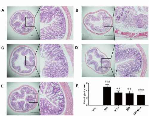 Figure 7 Representative colon tissue sections stained with hematoxylin and eosin visualized using a microscope.Notes: (A) control; (B) DSS; (C) NLCs; (D) BBR; (E) BBR-NLCs. (F) Colitis histological score for each group. The scale bar = 1000 µm. Data are expressed as mean ± SD (n = 6). ###P < 0.001 compared with the control group; **p < 0.01, ***p < 0.001 compared with the DSS group.