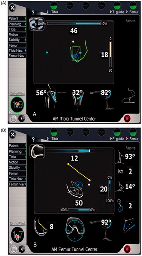 Figure 2. Computer-assisted navigation graphical user interface as used by the novice surgeon group, allowing the operator to understand the location on the tibial plateau and lateral femoral condyle of the right knee. (A) The interface for the tibial side. (B) The interface for the femoral side.