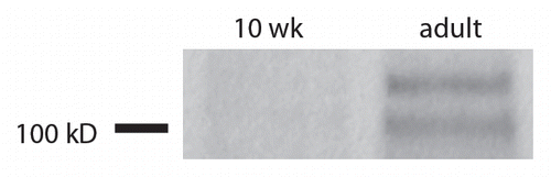 Figure 4 TEX11 protein is detected in the mature pig testis. TEX11 protein was only detected in the adult pig testis where complete spermatogenesis occurs. In the 10 week old testis, the only germ cells present were spermatogonia and TEX11 was undetectable. The estimated size of porcine TEX11 is slightly over 100 kD, which is similar to the size of homologs reported in mice and humans.
