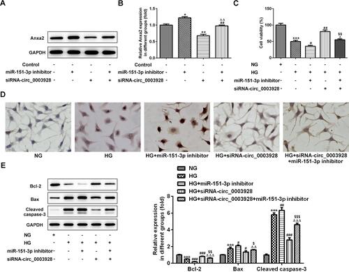 Figure 6 Hsa_circ_0003928/miR-151-3p axis regulates HG-induced viability loss and apoptosis in HK-2 cells. (A and B) HK-2 cells were transfected with miR-151-3p inhibitor or siRNA-circ_0003928, or co-transfected with miR-151-3p inhibitor and siRNA-circ_0003928, then the protein expression of Anxa2 was detected using Western blotting. *, **p<0.05, 0.01 vs control; ##p<0.01 vs miR-151-3p inhibitor; ΔΔp<0.01 vs siRNA-circ_0003928. (C) HK-2 cells were treated with NG or HG for 48 h. Besides, after transfection with miR-151-3p inhibitor or siRNA-circ_0003928 or the combination of iR-151-3p inhibitor and siRNA-circ_0003928, HK-2 cells were treated with HG for 48 h, then cell viability of different groups was assayed using CCK-8. (D) TUNEL assay was conducted to determine HK-2 cell apoptosis. (E) The protein expression of Bcl-2, Bax, cleaved caspase-3, and GAPDH were detected using Western blotting, and the band intensities were quantified. GAPDH acted as the loading control, and the band intensity was normalized to GAPDH. ***p<0.001 vs NG; #, ##, ###p<0.05, 0.01, 0.001 vs HG; Δ, ΔΔ, ΔΔΔp<0.05, 0.01, 0.001 vs HG+miR-151-3p inhibitor; $,$$,$$$ p<0.05, 0.01, 0.001 vs HG+siRNA-circ_0003928.