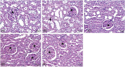 Figure 1.  Histomorphology of kidneys. Light photomicrographs of PAS-stained sections of kidney from control rats and ischemic kidney from rats treated with Mel and VD3. (A) Control group, (B) focal loss of epithelial brush border lining of tubular cells (arrow) in the I/R group, (C) Mel + I/R group, (D) VD3 + I/R group, and (E) Mel + VD3 + I/R group. Bar = 20 μm. Asterisk denotes glomeruli.