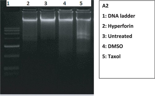 Figure 7. Effect of hyperforin and taxol on the DNA of MDA-MB-231 cells. DNA fragmentation was observed through the gel electrophoresis. DNA degradation was apparent in taxol treated MDA-MB-231 cells seen in 1.4% agarose gel electrophoresis. A very slight DNA fragmentation pattern hyperforin treated MDA-MB-231 cells compared with untreated and 0.1% DMSO treated cells.