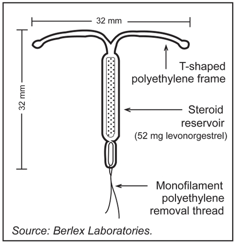 Figure 1 Levonorgestrel-releasing intrauterine system (LNG-IUS, Mirena®).Citation3