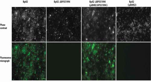 Figure 8. Immunofluorescence staining of bacterial cells with polyclonal anti-BPSS1996 antisera. B. pseudomallei Bp82, Bp82 ΔBPSS1996, Bp82 ΔBPSS1996 (pBHR2-BPSS1996) and Bp82 ΔBPSS1996 (pBHR2) were reacted with a murine polyclonal anti-BPSS1996 primary antibody, washed and stained with an anti-mouse Alexa 488-conjugated secondary antibody. Top panel, phase contrast; bottom panel, green fluorescence. Bar 10 µm.