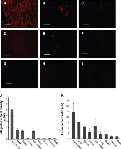 Figure 10 Fluorescence images and optical properties of tissue sections from a HeLa xenograft tumor.Notes: Fluorescence images of tissue sections from a HeLa xenograft tumor (A), liver (B), spleen (C), kidney (D), a A549 xenograft tumor (E), lung (F), ovary (G), intestine (H), and brain (I). Integrated fluorescence optical densities (J) and enhancement ratios (K) after injection of FAPLCS/SPIONs are shown. Scale bar =100 μm.Abbreviations: FAPLCS, folate-conjugated N-palmitoyl chitosan; SPION, superparamagnetic iron oxide nanoparticle.