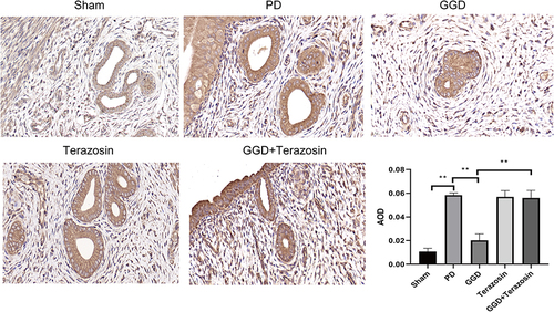 Figure 5 Inhibitory effects of Terazosin on the GGD-reduced NLRP3 expression. The protein levels of NLRP3 in the uterine tissue of rats in each group were detected by IHC and quantified (Magnification × 400). Data are presented as the means ± SD. **P<0.01, n=6.