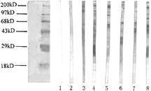 Figure 1 Western blot analysis of autoantibodies against mesangial cell in sera of patients with lupus nephritis (1). Lane 1: blank control; Lane 2: normal control; Lanes 3 and 4: sera from two patients with lupus nephritis recognized a 101 kD band; Lanes 5 and 9: sera from two patients with lupus nephritis recognized a 91 kD band; Lanes 6 and 7: sera from two patients with lupus nephritis recognized a 69 kD band; Lane 8: sera from a patients with lupus nephritis recognized 96 and 79 kD bands.