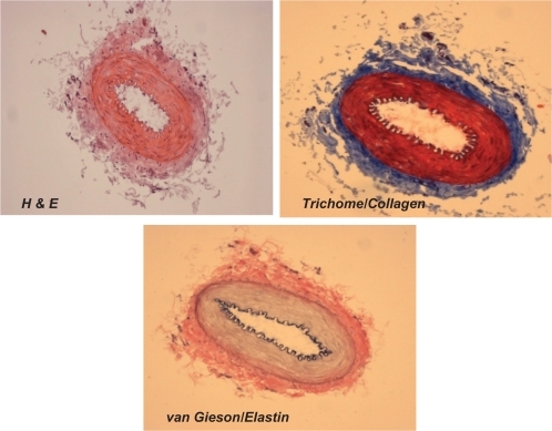 Figure 2A Different staining of femoral artery. Hematoxylin and eosin (H and E) staining was used to determine the general morphology of the blood vessels; the pinkish part represents the cytoplasm and the blue spots show the presence of nucleus in the artery wall. Masson trichrome staining was used for determination of collagen in tissue; the blue staining at the tunica adventitia represents the presence of collagen in the blood vessel; van Gieson staining was used to determine the presence of elastin in tissues; the blackish-brown staining in the tunica intima shows the presence of elastin in the artery.