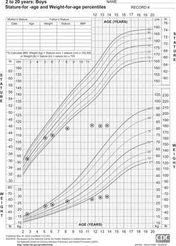 Figure 1 Growth chart demonstrating the typical growth pattern in patients with Hunter syndrome.