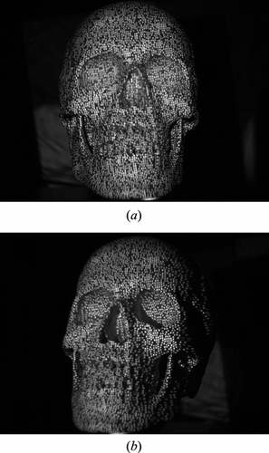 Figure 5. The stereo images with the projection of the M-Array pattern on the skull phantom, (a) the left camera image and (b) the right camera image.