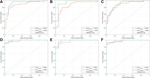 Figure 4 ROC curves were generated to assess the discriminative power of the Rad_Score ((A–C) show stages I, II, and III, respectively) and nomogram ((D–F) show stages I, II, and III, respectively) for predicting the subtype of lung cancer, including ADC and SCC.