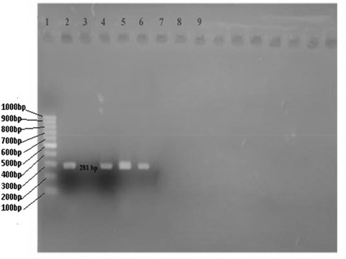 Figure 4 Agarose gel electrophoresis showing PCR-amplified OXA-48 gene (281 bp). Lane 1: 100 bp DNA ladder (Thermo Scientific); lane 2: positive control; lane 3: negative control; lanes 4–6: test plasmids positive for OXA-48 gene.