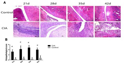 Figure 3 Results of H&E staining. (A) H&E staining of the ankle joint of rats in each group (HE x 100). The cartilage surface of the ankle joint in the control group was smooth, the joint space was normal, and there was no inflammatory cell infiltration in the tissue. In the CIA group, the surface of cartilage was uneven. On day 21, synovial membrane was markedly thickened, numerous inflammatory cells were infiltrated, and the joint space was narrowed. On day 28, synovial villus extended into the articular cavity. The articular cartilage surface was damaged on day 35 and appeared as necrotic and exfoliated on day 42. Bars = 50 μm. (B) Histopathological scores of each group. The scores of each model group were significantly higher than those in the control groups (z = −2.668, −2.660, −2.668, −2.660, P < 0.05) (Mann–Whitney U-test). #P < 0.05.