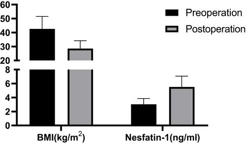 Figure 1 Preoperation vs 1 year postoperation in BMI and nesfatin-1.