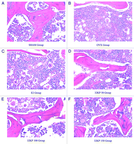 Figure 2. Hematoxylin-eosin staining of OVX, SHAM, E2 and different dose 32KP (A–F). The marrow cavity of the femurs was observed by light microscopy (X40).