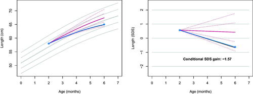 Figure 1. Observed length curve (blue) plotted on top of the personalised reference (solid red: predicted growth; dotted red: centiles -2, -1, +1, +2 SD of the prediction interval), in the measurement scale (left) and the SDS scale (right). The conditional SDS gain at month 6 is equal to -1.57, just above thrive line at -1.64 (solid black). The grey lines in the background correspond to the height references for girls from the Fourth Dutch Growth Study.