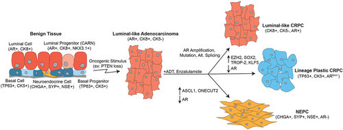 Figure 2. Prostate cancer initiation and progression. Several epithelial cell types, including luminal, basal, and neuroendocrine cells, have been suggested as potential cells of origin for prostate cancer. However, the majority of primary prostate cancer has a luminal-like adenocarcinoma phenotype, defined by CK8 and AR expression. Treatment with AR-targeted therapies like ADT and enzalutamide can be initially effective, but invariably bring about heterogenous CRPC subtypes. These include luminal-like CRPC with restored AR signaling, lineage plastic CRPC with reduced or lost AR activity and increases in basal cell phenotypes, and NEPC with complete loss of AR and gain of NEPC markers CHGA, SYP, and NSE.