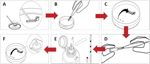 Figure 2. SpermVD® protocol. A. 1 µl of a cryoprotectant solution is placed on each well. B. The SpermVD® is placed under oil on a search plate. C. Spermatozoa are transferred from the collection droplets to the SpermVD®. D. The SpermVD® is inserted into a cryotube. E. The cryotube is placed in LN2. F. Warmed SpermVD® is placed on an ICSI dish and spermatozoa are transferred to washing medium droplets.