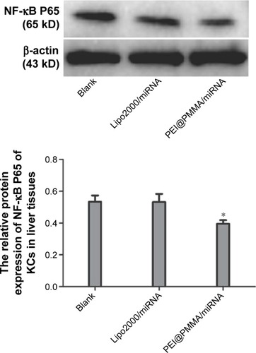 Figure 9 Western blot analysis of NF-κB P65 protein extract from mice KCs of extracted from liver tissues with different treatments.Note: *P<0.05 compared to control and Lipo2000/miRNA groups.Abbreviations: KCs, Kupffer cells; Lipo2000, Lipofectamine 2000; NF-κB, nuclear factor κB.
