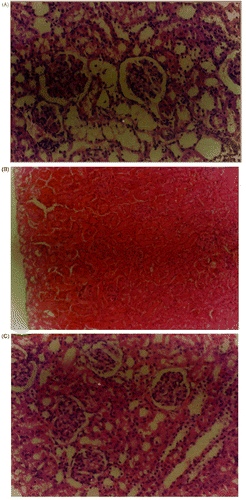 Figure 7. Light microscopic observations of kidney sections of different treatment groups: (A) renal cortex of a sham control rat (HE, X280); (B) severe hyaline casts, tubular necrosis and medullary congestion in kidneys of rats subjected to ischaemia-reperfusion. (HE, X280); (C) mild hyaline casts and medullary congestion in kidneys of ischaemia-reperfused rats pretreated with U-74500A 4.0 mg/kg (HE, X280).