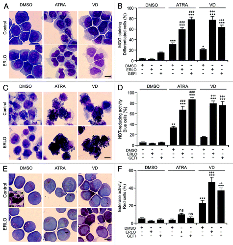 Figure 3. Morphological and functional assessment of the differentiation-inducing activity of EGFR inhibitors. (A–F). Human acute myeloid leukemia HL-60 cells were treated with 10 μM erlotinib (ERLO), 10 μM gefitinib (GEFI), or an equal volume of DMSO, alone or in combination with 100 nM all-trans retinoic acid (ATRA), or 50 nM 1α,25-hydroxycholecalciferol (VD), for 3 d, then cytospun and processed for the cytochemical assessment of myeloid differentiation upon May–Grünwald–Giemsa staining (Aand B) or the colorimetric detection of NADPH oxidase (C and D) or α-naphtyl acetate esterase (E and F) enzymatic activities. Panels (A, C, and E) depict representative images (scale bars = 10 µm), whereas quantitative data on the percentage of cells exhibiting morphological signs of differentiation (decreased cytoplasmic basophilia, nuclear lobulation and cytoplasmic granulation), nitroblue tetrazolium chloride (NBT)-reducing activity and α-naphtyl acetate esterase activity are reported in (B, D, and F), respectively (means ± SEM; n = 3 with at least 100 cells/condition). The inset in (E) depicts a megakaryocyte (M) exhibiting intense α-naphtyl acetate esterase activity (positive control). *P < 0.05, **P < 0.01, ***P < 0.001 (ANOVA plus Dunnett post-hoc test), as compared with DMSO-treated cells; n.s., not significant, ###P < 0.001 (ANOVA plus Bonferroni post-hoc test), as compared with ATRA-treated cells; ++P < 0.01, +++P < 0.001 (ANOVA plus Bonferroni post-hoc test), as compared with VD-treated cells.