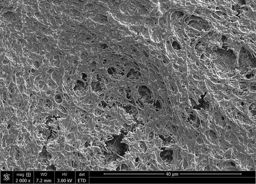 Figure 1. Scanning electron microscope (SEM) image of mature plaque biofilm grown on collagen-coated hydroxyapatite disks.