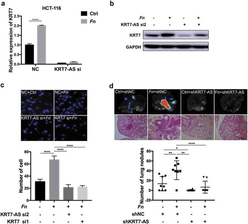 Figure 4. Fn promoted metastasis of CRC by modulating KRT7-AS/KRT7. (a,b) HCT-116 cells were transfected with siRNA targeting KRT7-AS and then incubated with Fn. qRT-PCR (a) and western blot (b) indicated that knockdown of KRT7-AS suppressed the Fn-induced upregulation of KRT7. (c) HCT-116 cells were transfected with siRNA targeting KRT7-AS or KRT7 and then incubated with Fn or PBS. Transwell assay was performed. Migrated cells were stained with DAPI and images were randomly taken under microscope. Every 6 fields were counted for each sample. (d) HCT-116 cells were stably transfected with KRT7-AS shRNA or control lentivirus and then incubated with Fn or PBS for 24 h. Then, above-prepared cells were injected into nude mice via tail vein (n = 8 each group). The number of metastatic nodules in lung was counted in each slide after H&E staining (scale bar = 100 μm). GFP signal shows metastatic HCT-116 cells infected by lentivirus in lungs. All data are shown as mean ± SD, *p < .05, **p < .01, ****p < .0001 (unpaired Student’s t-test). NC, negative control; Fn, Fusobacterium nucleatum; si, siRNA.