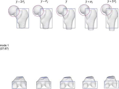 Figure 16. Femur atlas: 27.67% of the shape variation is encoded in the first mode. The color shapes highlight the local shape variation.