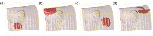 Figure 15. Individual SAR contribution of the applicators. Relative scaling: (a) [5 0 0 0], (b) [0 5 0 0], (c) [0 0 5 0] and (d) [0 0 0 5]. Isosurface at 10 W/kg. The applicators are represented schematically by their square aperture of 10 × 10 cm2.