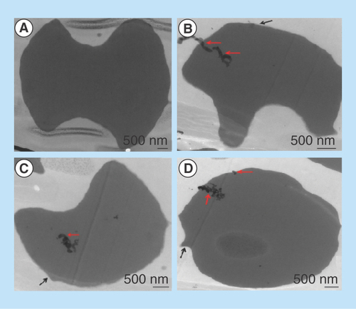 Figure 3.  Representative TEM images of red blood cells treated with 80 µg/ml O-GNR-PEG-DSPE for 3 h or left untreated.(A) Representative TEM image of cross section of red blood cell not treated with O-GNR-PEG-DSPE. (B) Representative TEM image of cross section of a red blood cell treated with PEG-DSPE showing loss of concave shape on one side (black arrow). (C) Representative TEM image of cross section of a red blood cell treated with PEG-DSPE showing loss of concave shape on both sides. (D) Representative TEM image of cross section of a red blood cell treated with O-GNR-PEG-DSPE showing formation of a spherical cross section due to loss of structural integrity of the cells. O-GNR-PEG-DSPE particles are indicated with red arrows whereas protrusions/fragmentation from the membrane are indicated with black arrows.O-GNR-PEG-DSPE: Graphene nanoribbon, 1, 2-distearoyl-sn-glycero-3-phosphoethanolamine-N (amino [polyethylene glycol]).