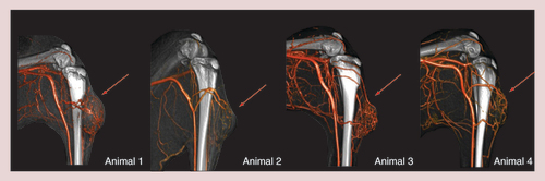 Figure 6. Angiographic images of the left hind limb of rabbits with subcutaneous implanted VX2-tumors.Angiographic presentation (3D volume rendering technique [VRT]) of four different VX2-tumors, each implanted at the left hind limb of four New Zealand white rabbits (bones and soft tissue are displayed in grey; vessels are displayed in dark orange. In all four animals, the tumor is placed lateral at the left hind limb approximately 2 cm below the knee. Although some similarities can be seen, the vascularization of all four tumors is very different. For an effective treatment with magnetic drug targeting an exact knowledge of the tumor vascularization is crucial for placing the magnetic field at the right position. Red arrow: tumor area.