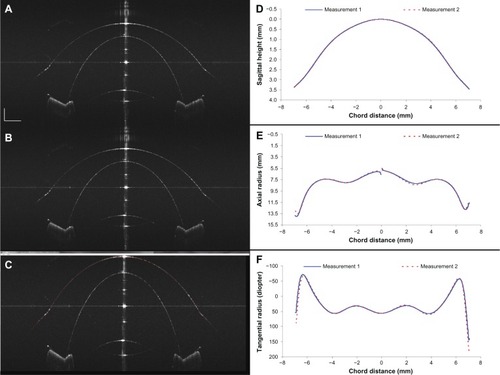 Figure 10 Precision of measuring the ocular surface.