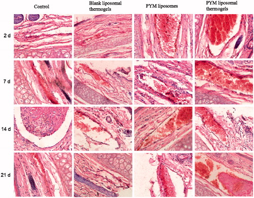 Figure 8. Histological sections of rabbit ear veins after administration of normal saline solutions, blank liposomal thermogels, PYM liposomes and PYM liposomal thermogels for 2, 7, 14, 21 days (40×).