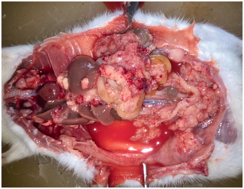 Figure 2. Peritoneal carcinomatosis after intraperitoneal transplantation of ovarian cancer in rat. The autopsy of the rats reveals merging peritoneal tumour implants of greater and lesser omentum, mesentery, diaphragm dome, and miliary involvement of visceral and parietal peritoneum.