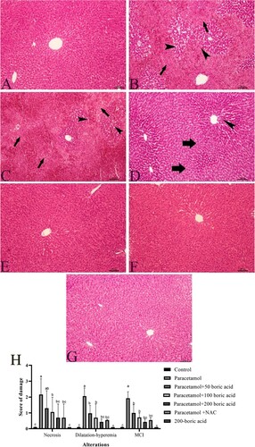 Figure 1. The effects of the boric acid and paracetamol on histopathological alterations in rat liver tissue. Arrow: necrosis and mononuclear cell infiltrations in the pericentral region of the liver, arrowhead: sinusoidal dilatation and hyperemia, A: Control; B: Paracetamol; C: Paracetamol + 50 boric acid; D: Paracetamol + 100 boric acid; E: Paracetamol + 200 boric acid; F: Paracetamol + NAC; G: 200 boric acid. All figures are stained with H&E. 20x, and 100 µm were used as the original magnifications. H: Damage score of histopathological alterations. 0-no damage, 1-slight, 2-moderate, 3-severe, or 4-most damaged. MNI: mononuclear cell infiltrations. a,b,c,d:Different letters in the same column were statistically significant, p < 0.05.