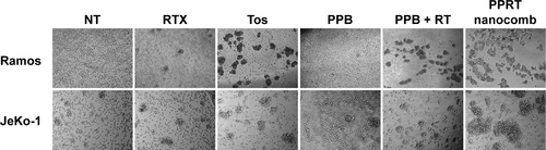 Figure S1 Effects of PPRT nanocomb and free mAbs on homotypic adhesion formation.Notes: Ramos and JeKo-1 cells were treated with 2.5 μg/mL therapeutic antibodies or PPRT nanocombs for 8 hours and cell morphology was observed by a light microscope. Magnification: 20×.Abbreviations: NT, no treatment; PPB, polyethylenimine polymer–BSA; PPRT, polyethylenimine polymer–RTX–Tos; RT, rituximab+tositumomab; RTX, rituximab; Tos, tositumomab.