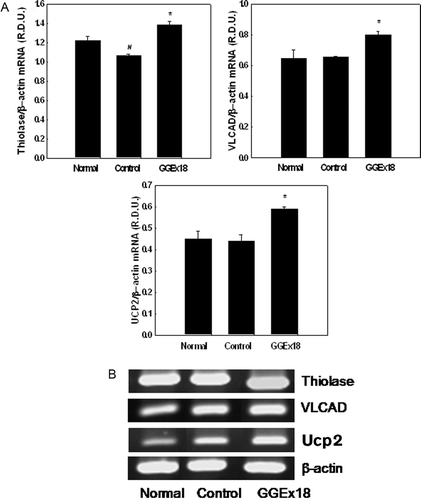 Figure 4.  Effects of Gyeongshingangjeehwan 18 (GGEx18) on PPARα target gene mRNA levels in high-fat diet-induced obese mice. (A)Adult male C57BL/6 mice (n = 8/group) were fed a low-fat diet (Normal), a high-fat diet (Control), or the high-fat diet supplemented with 250 mg/kg/day GGEx18 for 9 weeks. Total cellular RNA was extracted from liver tissue, and mRNA levels were measured using RT-PCR. Data are reported as the mean ± standard deviation of relative density units (R.D.U.) using β-actin as a reference. #p < 0.05 compared with the normal group, *p < 0.05 compared with the control group. (B) Representative RT-PCR bands from one of four independent experiments are shown.