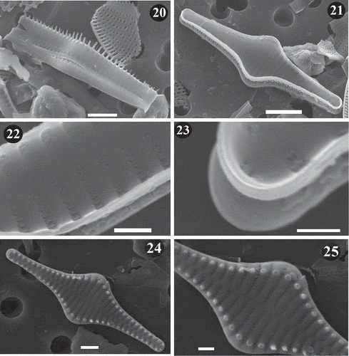 Figs 20–25. SEM images of Staurosira inflata. Lake Ladoga and Lake Ilmen material. Fig. 20. Side view of two neighbouring frustules showing unperforated girdle bands. Notice longer spines at the central part of the valve. Fig. 21. General internal view of frustule. Notice lack of rimoportulae. Fig. 22. Inner view of frustule. Notice vola occlusion of areolae and raised interstriae. Fig. 23. Inner view of apex. The small apical pore field can be seen. Fig. 24. General external view of frustule. Notice striae perpendicular to the apical axis at the valve centre and slightly radial at the ends. Fig. 25. Close up of valve in Figure 24 showing striae that extend onto the valve mantle. Scale = 5 µm (Fig. 21), 4 µm (Fig. 20), 2 µm (Fig. 24), 1 µm (Figs 22, 25), 0.5 µm (Fig. 23).