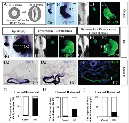 Figure 1. The phenotypes of abnormal heart tube formation following treatment with high glucose. (A) A cartoon illustrating that the fertilized chick eggs were incubated in the presence of mannitol (control) or 50 mM glucose (high glucose) until the embryos reached HH11 stage. (B-B2) VMHC in situ hybridization was performed in HH11 control embryos (B). A high-magnification image focused on the developing heart tube (B1). The corresponding level of transverse section was indicated by the white dotted line in B1 (B2). (C-C2) MF-20 fluorescence immunostaining was performed in HH11 control embryos. C and C1 are bright-field and fluorescence images, respectively. C2 is the high-magnification image focused on the developing heart tube. (D-D2) VMHC in situ hybridization was performed in HH11 high-glucose-treated embryos (D). D1 is the high-magnification image focused on the developing heart tube. D2 is the transverse section at the level indicated by the white dotted line in D1. (E-E2) MF-20 fluorescence immunostaining was performed in HH11 high-glucose-treated embryos. E and E1 are bright-field and fluorescence images, respectively. E2 is the high-magnification image focused on the developing heart tube. (F-F3) MF-20 fluorescence immunostaining was performed in HH11 high-glucose-treated embryos. F and F1 are bright-field and fluorescence images, respectively. F2 is the high-magnification image focused on the developing heart tube. F3 is the transverse section at the level indicated by the white dotted line in F2. (G) Bar chart showing the frequency of heart tube hypertrophy. (H) Bar chart showing the frequency of dextrocardia. (I) Bar chart showing the frequency of heart tube fusion anomaly. Abbreviations: Ctr, control and HG, high glucose. Scale bars = 500 μm in B, C-C1, D-D1, E-E1 and F-F1; 100 μm in B1, C2, D1, E2, F2; 100 μm in B2, D2, F3.