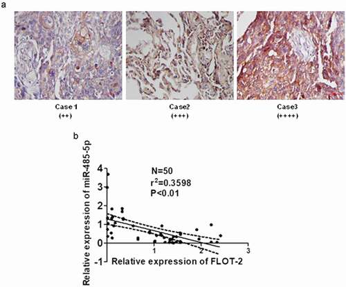 Figure 8. Relationship between MiR-485-5p level and FLOT2 expression in SCLC tissues. (a), immunohistochemical staining of FLOT2 on the tissue sections of SCLC; (b), negative correlation between miR-485-5p and FLOT2 mRNA level; FLOT2 mRNA and miR-485-5p were measured by RT-qPCR, and Pearson correlation analysis shows a negative correlation between miR-485-5p and FLOT2 mRNA level (n = 50, r = −0.5991, p < 0.01).