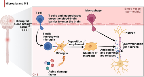 Figure 6 In MS, microglia can affect neurons through phagocytosis through microglial cluster formation that destroys myelin sheaths. The flowchart was created using Biorender.com.