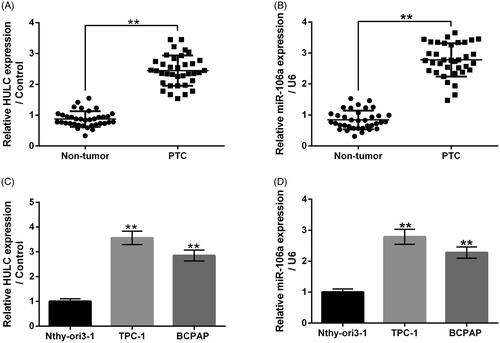 Figure 1. HULC and miR-106a had relative high expression levels in PTC tissues and cells. The HULC and miR-106a expression in PTC tissues and corresponding normal tissues (A and B), along with in human thyroid follicular cell line Nthy-ori3-1 and human PTC cell lines TPC-1 and BCPAP, were measured. **p < .01.