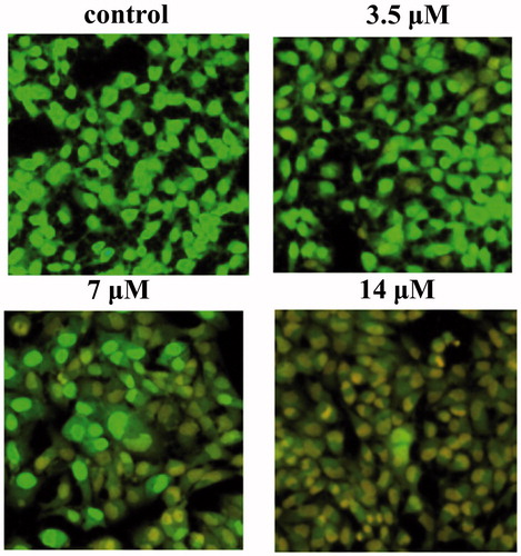 Figure 2. Representative images (200×) of fluorescent microscopic analysis of MCF-7/ADR cells without treatment (control) and treated with 3.5, 7, 14 μM of AB. Cells are stained with AO/EB.