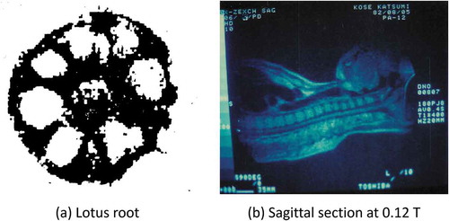 Figure 1. (a) A cross-sectional image of lotus root measured by continuous wave NMR and the projection method acquired in 1979. It was measured by Dr. Kozo Sato (University of Tokyo) and reconstructed by Dr. Tamon Inouye (Toshiba). The static magnetic field strength was 0.4 T. The number of projections was 36 per 180 degrees. (b) The author’s sagittal image acquired by the projection method on 5 August 1982, using a 0.12 T air-core electromagnet at Toshiba Central Hospital in Tokyo. This image was reconstructed from 180 projection data acquired with a spin-echo sequence (TR = 400 ms). The measurement time was 9 minutes and 36 seconds