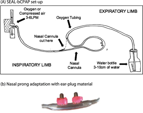 Figure 1. (A) SEAL-bCPAP set-up (device constructed from oxygen tubing, nasal cannula, plastic water bottle and tape/glue); (B). Nasal prong adaptation with ear-plug material.