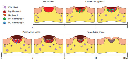 Figure 1 Schematic representation of the phases and timeline of the skin healing process in mice. Four overlapping phases shown schematically result in wound closure. The cellular processes at each stage are described in detail in “Normal skin healing process in mice”.