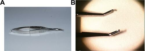 Figure S1 Sheppard conjunctival forceps (Bausch & Lomb, Rochester, NY, USA): (A) full view and (B) forceps tips.