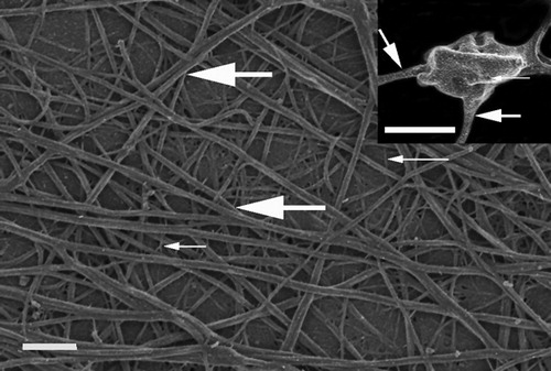 Figure 1. Fibrin network prepared by adding thrombin to platelet rich plasma. Thick, white arrow = major, thick fibers; Thin, white arrow = minor, thin fibers. Scale = 1 μm. Insert: platelet with thin, white arrow indicating open canalicular membrane pore; thick white arrow = major fibers leaving platelet. Scale = 1 μm.