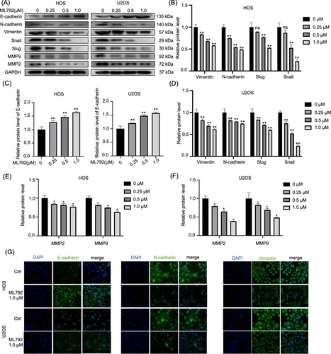 Figure 4. ML792 rebalances epithelial-mesenchymal transition (EMT)-related proteins in human osteosarcoma cells (HOCs). (A–F) Migration, invasion, and EMT-related proteins were analyzed by Western blot. (G) Immunofluorescence was used to analyze the protein expressions of Vimentin, N-cadherin, and E-cadherin in HOCs. Magnification, 200x. *P < 0.05, **P < 0.01 vs ML792(0 µmol/L) group.