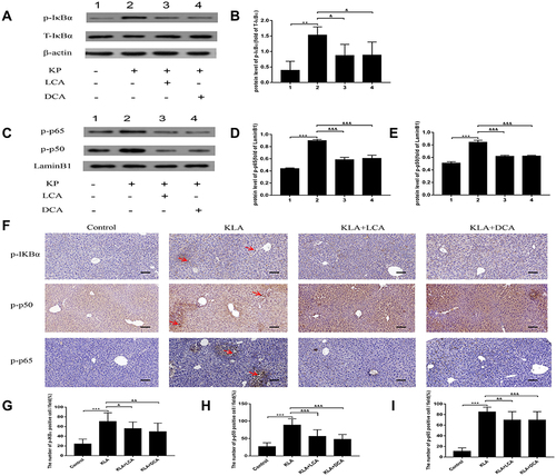 Figure 5 Effects of SBAs on NF-κB signaling in the livers of K. pneumoniae infected mice. (A) Representative gels for p-IκBα (upper panel), IκBα (middle panel), and β-actin (lower panel) are shown. (B) Quantitative analysis of p-IκBα was performed by scanning densitometry. (C) Representative gels for p-p65 (upper panel), p-p50 (middle panel), and LaminB1 (lower panel) are shown. (D) Quantitative analysis for p-p65 was performed by scanning densitometry. (E) Quantitative analysis for p-p50 was performed by scanning densitometry. (F) Representative photomicrographs of liver p-IκBα, p-p50, and p-p65 are consecutively shown. Original magnification: 200×. The red arrowheads indicate p-IκBα, nuclear p50, and p65-positive cells, respectively. (G) p-IκBα-positive cells were compared between different groups. (H) Nuclear p50-positive cells were compared between different groups. (I) Nuclear p65-positive cells were compared between different groups. All experiments were duplicated for three times. Data are expressed as means ± S.E.M (n = 10); **P < 0.01,***P < 0.001 as compared with healthy controls; &P < 0.05, &&P < 0.01, &&&P < 0.001 as compared with KLA mice.
